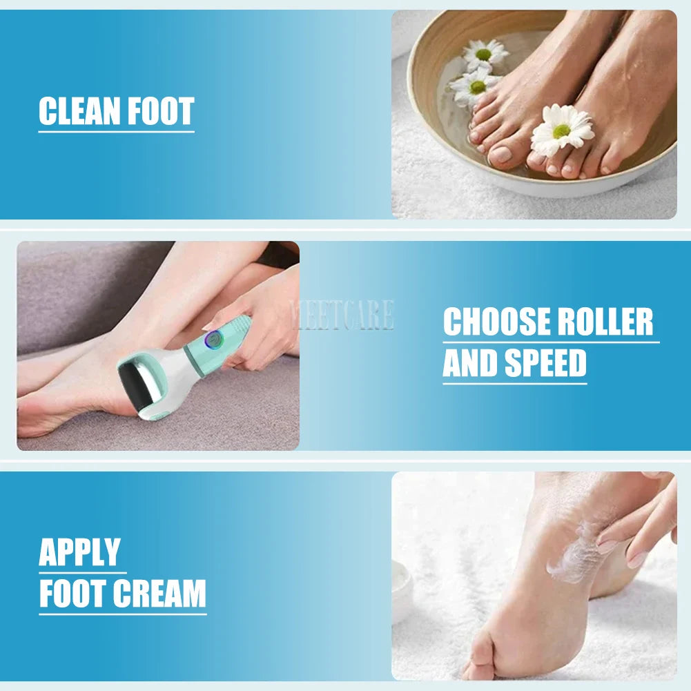 SmoothStep Pro™ – Electric Callus Remover