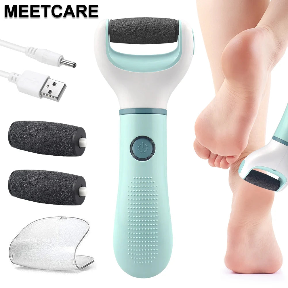SmoothStep Pro™ – Electric Callus Remover