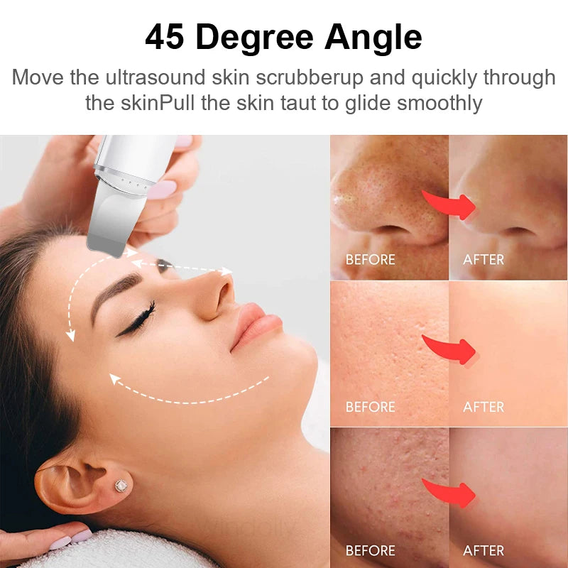 GlowSonic Pro™ – Ultrasonic Skin Scrubber