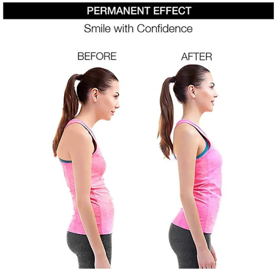 Gadgit Co™ – Adjustable Back & Shoulder Posture Corrector