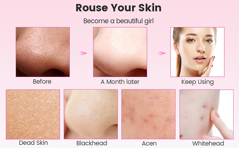 GlowSonic Pro™ – Ultrasonic Skin Scrubber