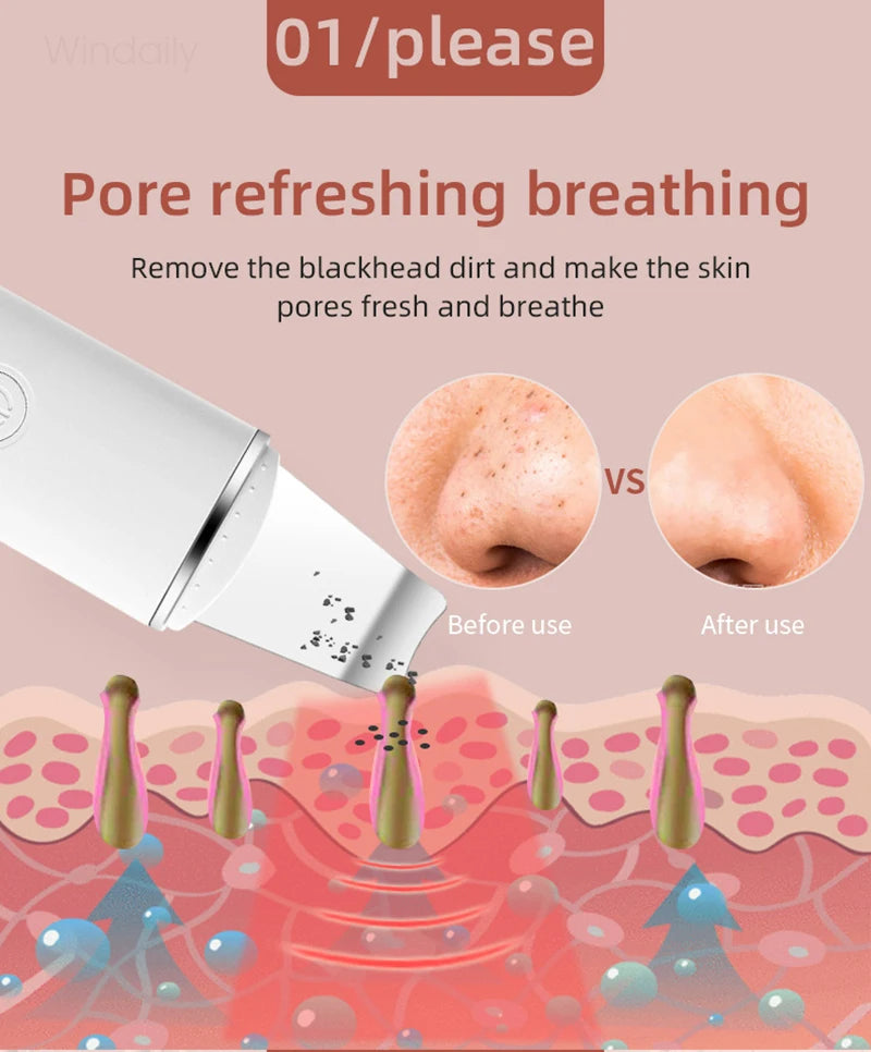 GlowSonic Pro™ – Ultrasonic Skin Scrubber
