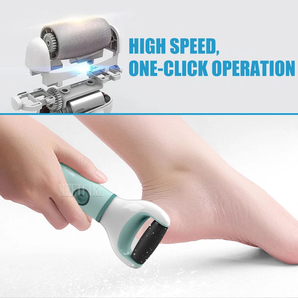SmoothStep Pro™ – Electric Callus Remover